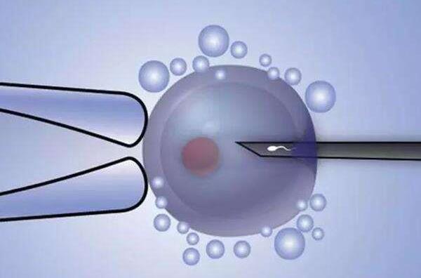 第三代试管婴儿三代试管筛查囊胚谨慎移植探讨