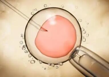 试管婴儿鲜胚和冻胚从冻胚试管婴儿到鲜胚的选择