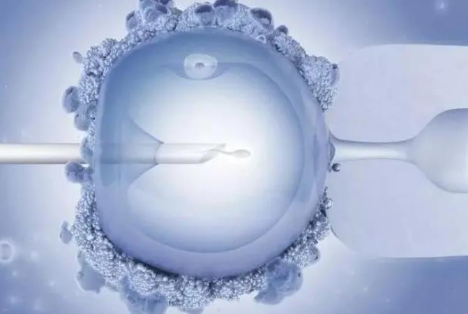 试管婴儿能避免染色体异常吗，专家告诉你标准答案